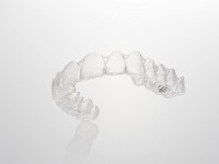 staffによるマウスピース矯正治療体験